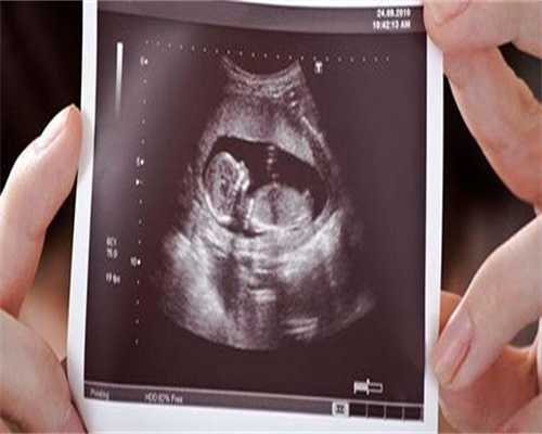 如何提高代生价格表成功率_如何提高代生价格表成功率，多个方面分析！