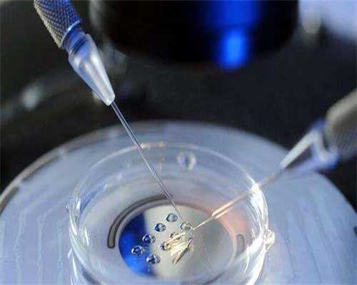 代孕哪家成功率高,原理、准确率、费用...多方面了解精子分离术