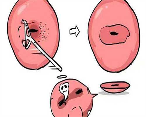 济南做试管预约哪个医院,济南做试管比较好的医院！