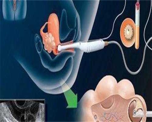 D6囊胚移植能否成功?