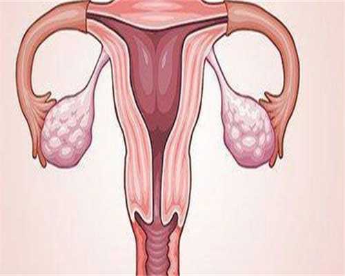 做三代代生孩子机构早餐吃什么比较好？附三代代生孩子机构流程！